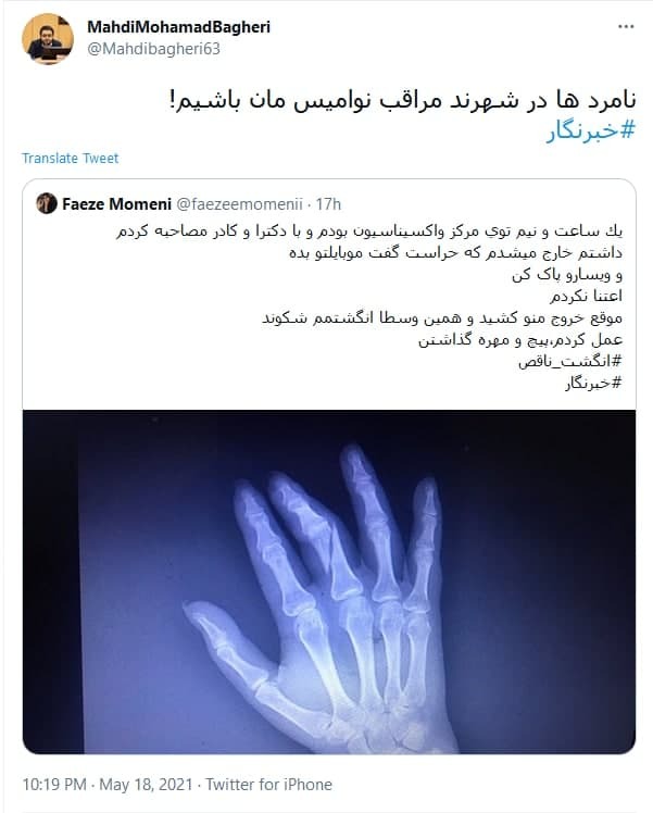 واکنش کاربران به شکستن دست خبرنگار زن