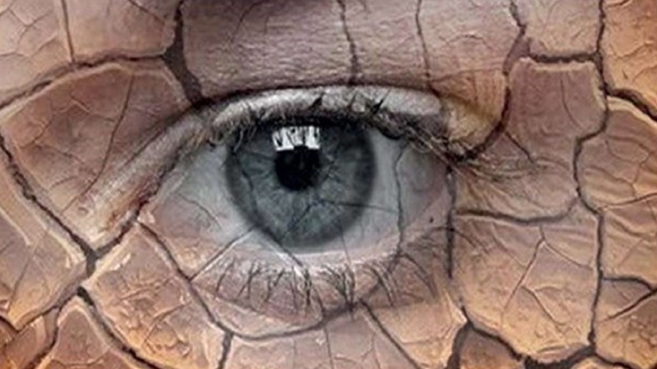 خشکی چشم‌ها در زمان یائسگی