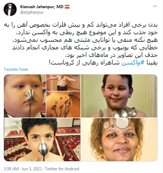 ماجرای آهنربایی شدن بدن بعد از تزریق واکسن کرونا چیست؟ ماجرای آهنربایی شدن بدن بعد از تزریق واکسن کرونا چیست؟