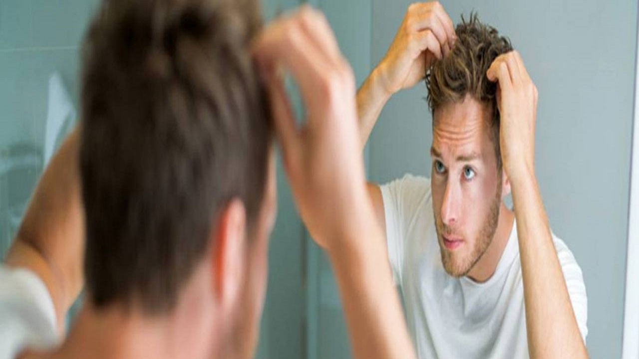هرآنچه آقایان از ریزش مو باید بدانند
