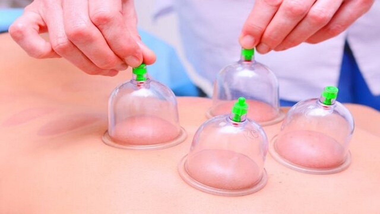 فوائد حجامت در درمان بیماری‌های مختلف کدام است؟