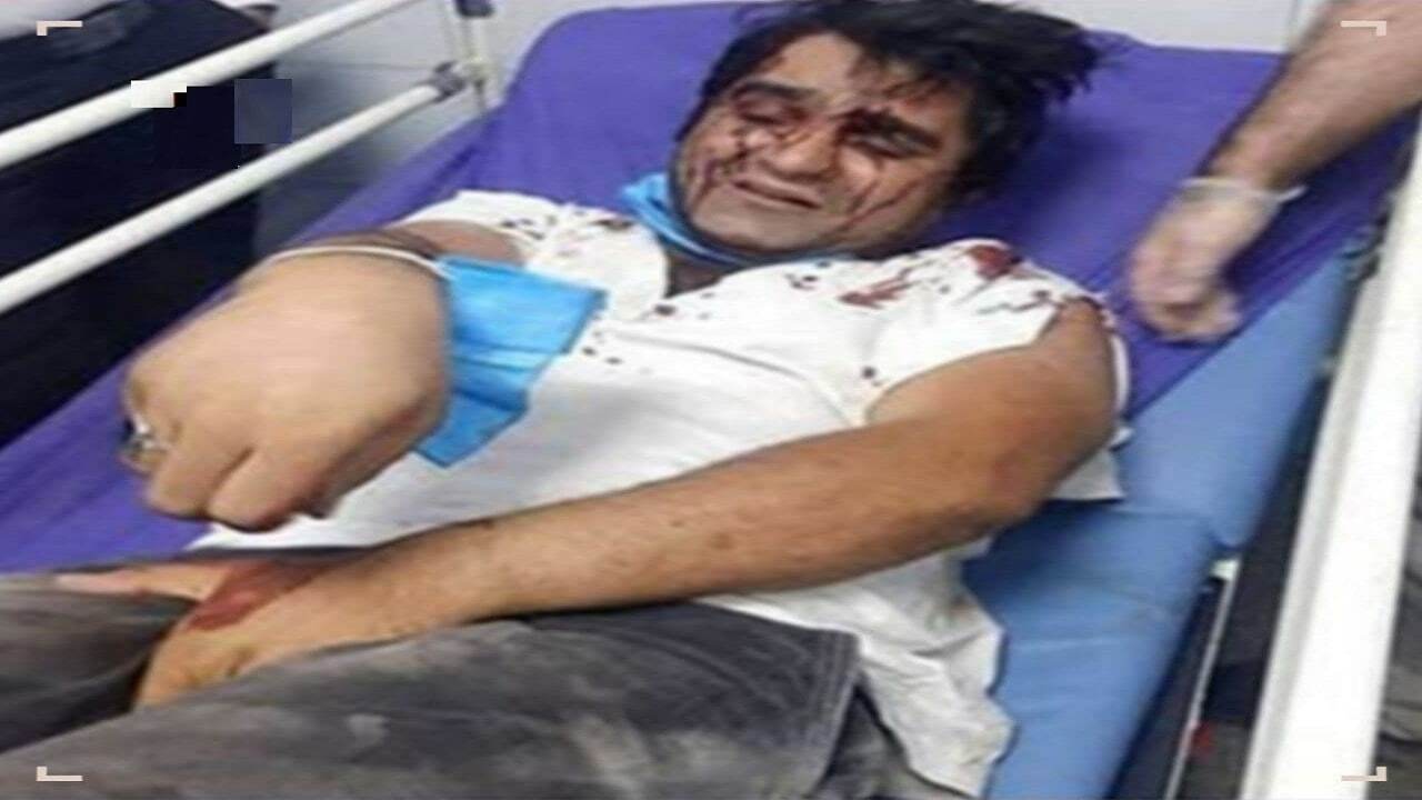ورود پلیس به ماجرای حمله افراد ناشناس به بازیگر تلویزیون + عکس