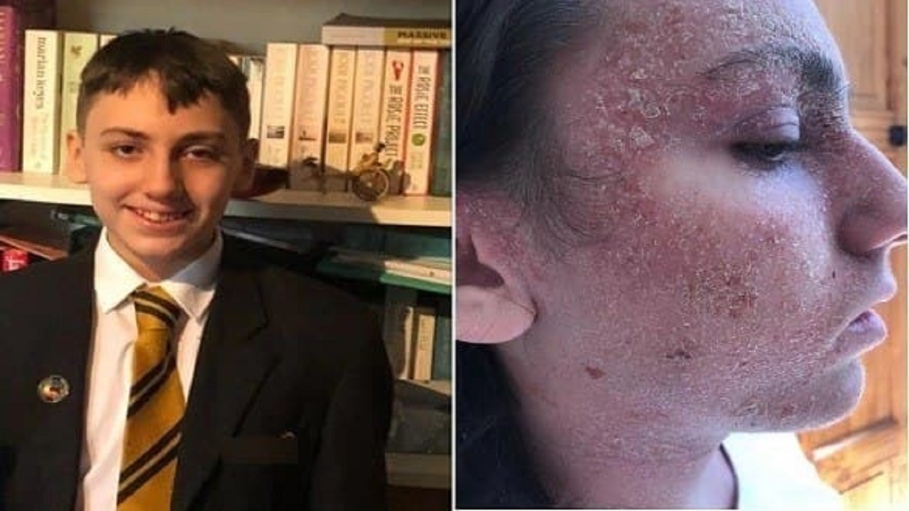 درخواست عجیب یک نوجوان برای رهایی از درد شدید بیماری‌اش