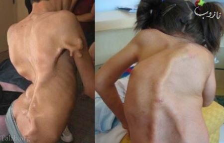 تصاویر انسان&zwnj;های ناقص الخلقه و عجیب جهان