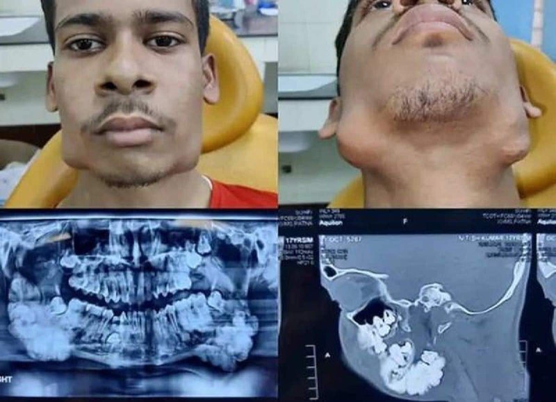 پسر نوجوان