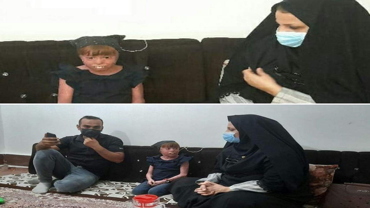 دختر خرمشهری مبتلا به بیماری پوستی این روزها متاثر از بی آبی/ خیرین ورود کردند