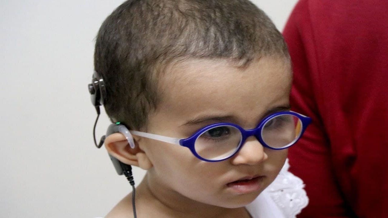بازگشت حس شنوایی در ۲ کودک مازندرانی