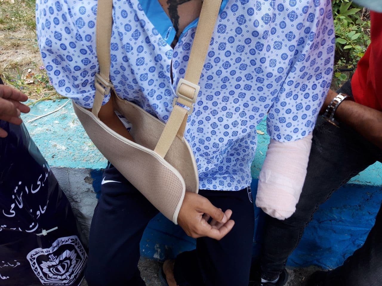 قطع دست جوان ۱۸ ساله در نزاع خیابانی + عکس