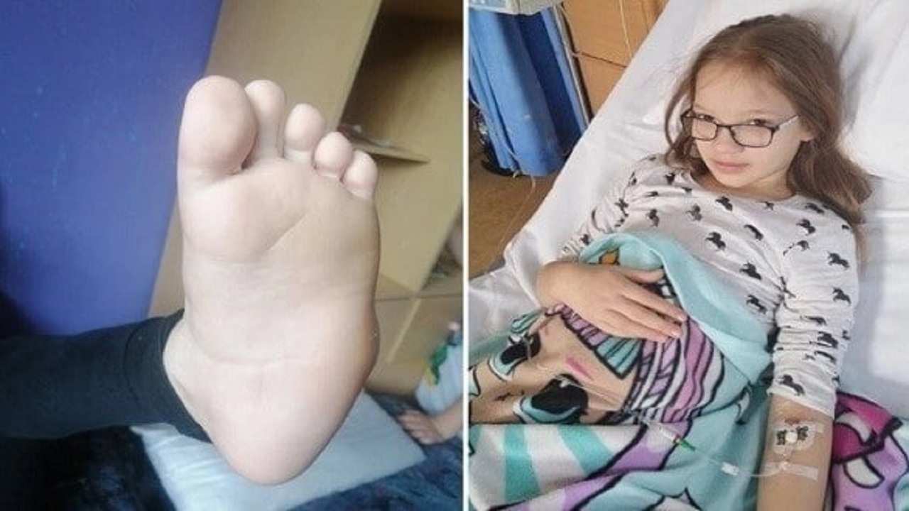 دختر بچه‌ای که می‌خواهد پزشکان پای او را قطع کنند + تصاویر