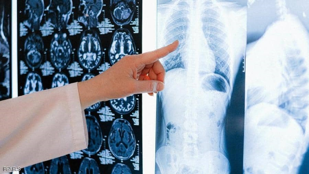 پژوهشی جدید در خصوص چگونگی آسیب رساندن کرونا به ریه افراد