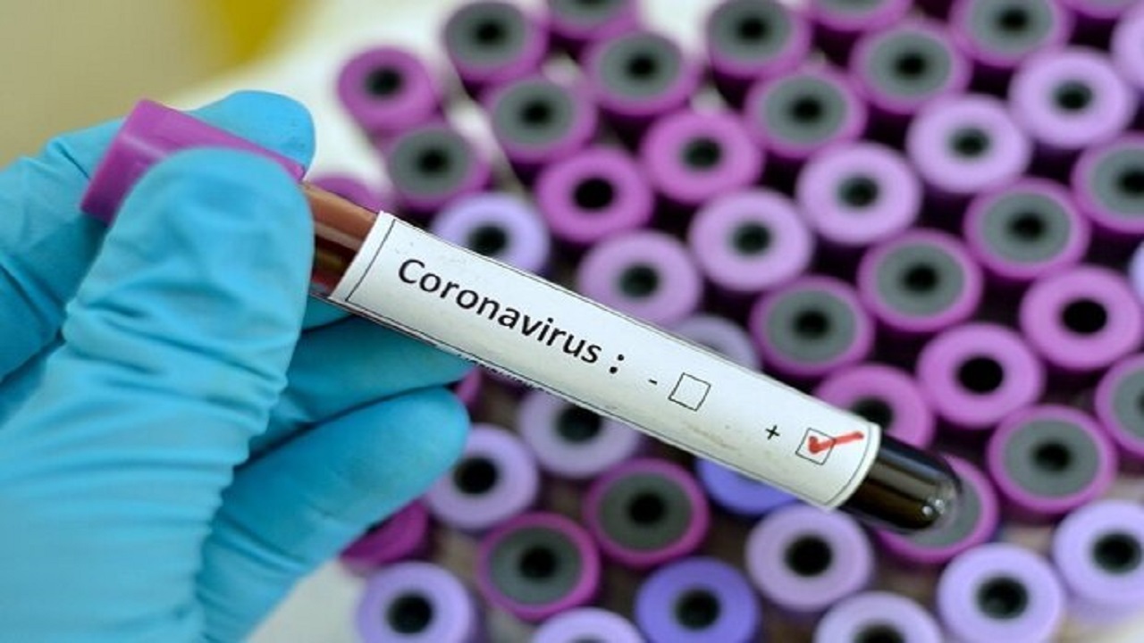 شناسایی ۲۵۰ مورد مبتلا به کرونا در شبانه روز گذشته در سمنان