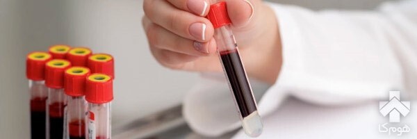 چگونه آزمایش خون را تفسیر کنیم؟