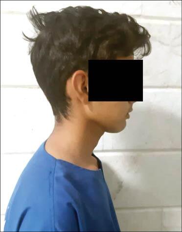 گفتگو با کم سن&zwnj;ترین قاتل سریالی / احسان فقط ۱۵ سال دارد + عکس