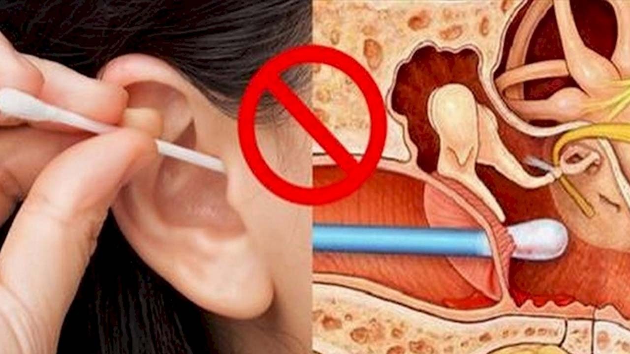 چرا نباید از گوش‌ پاک‌کن استفاده کنیم؟