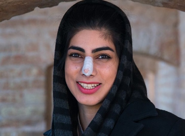 ۸ معیار عجیب زیبایی در کشور&zwnj;های آسیایی را بشناسید