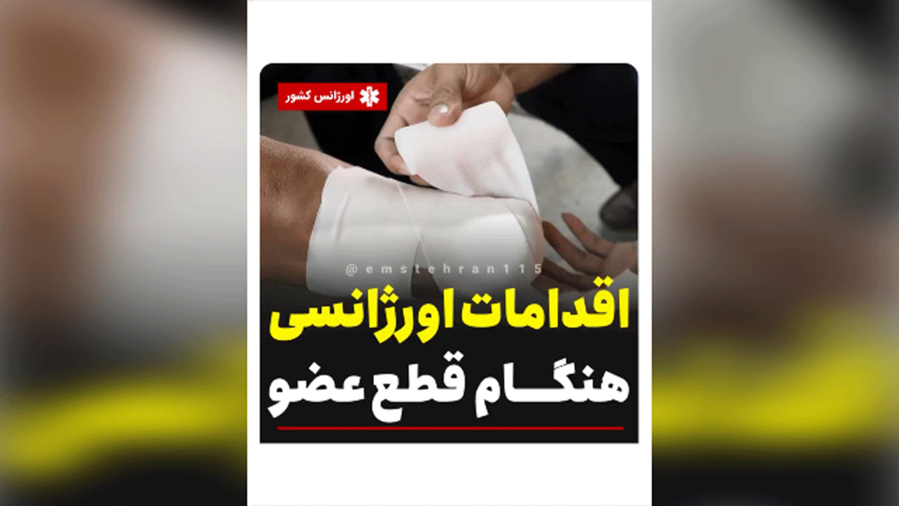 اقدامات اورژانسی هنگام قطع عضو + فیلم