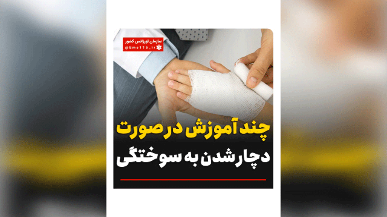 در صورت سوختگی چه کارهایی باید انجام داد؟ + فیلم