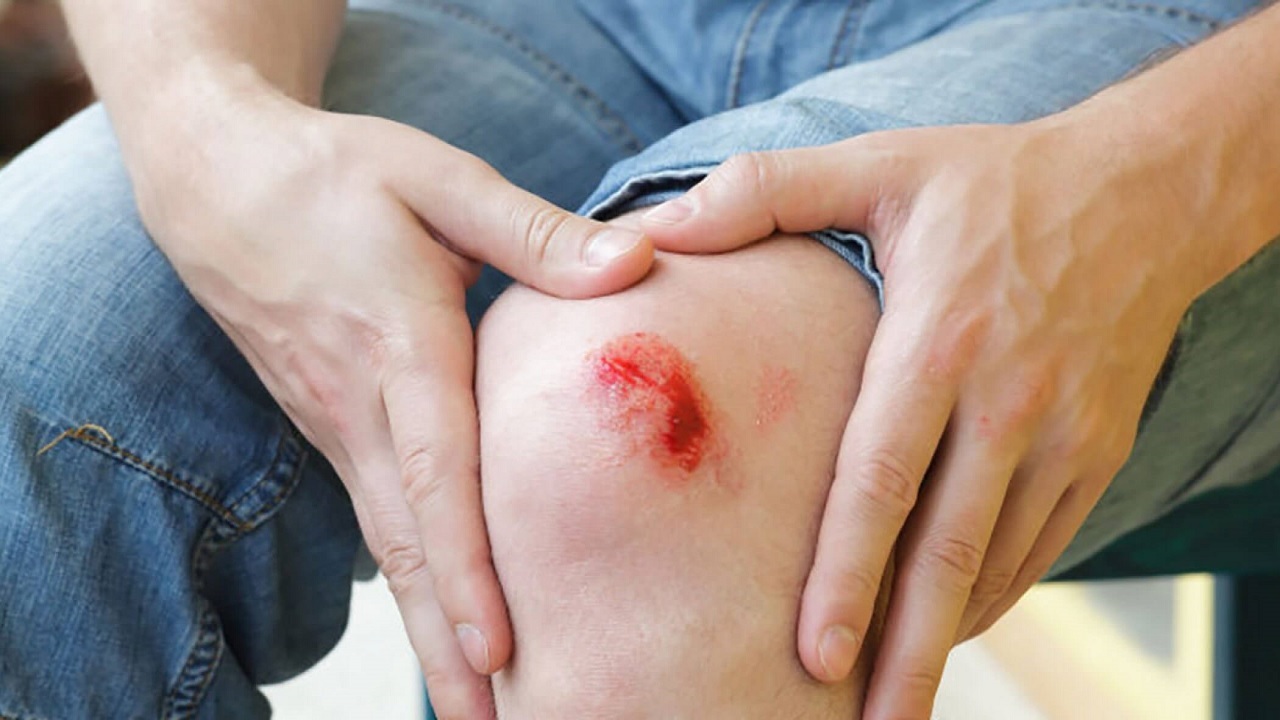 چرا برخی اندام‌ها پس از جراحت بهبود می‌یابند؟