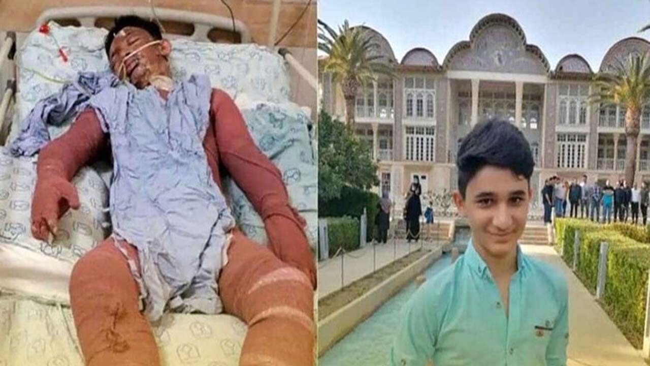 آخرین وضعیت نوجوان فداکار دهه هشتادی از زبان پزشک معالج