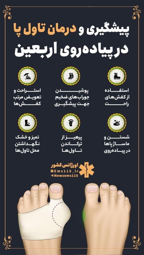 پیشگیری و درمان تاول پا در پیاده روی اربعین