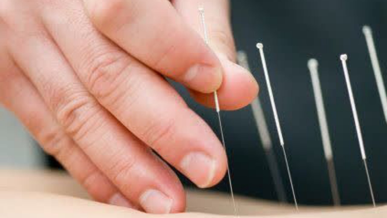 فعالیت رسمی ۷ پزشک طب سوزنی در اصفهان