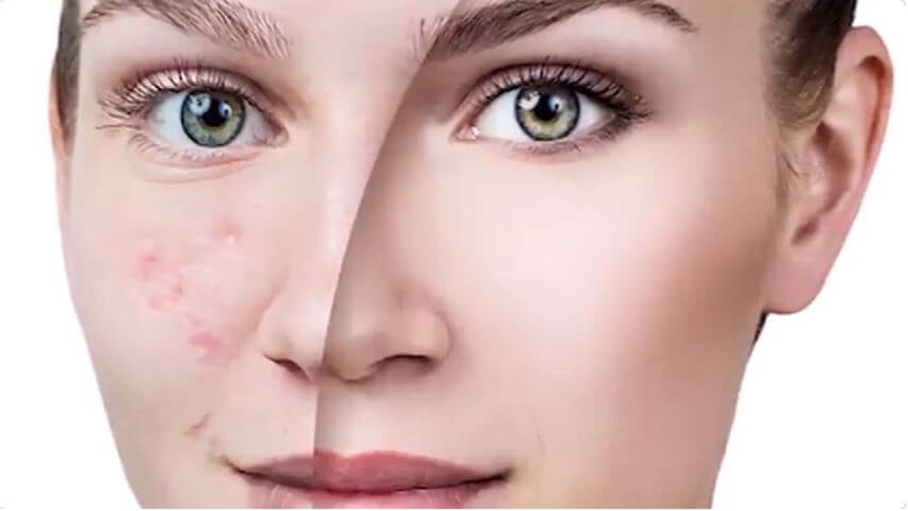 کرم ضد لک را چند بخریم؟