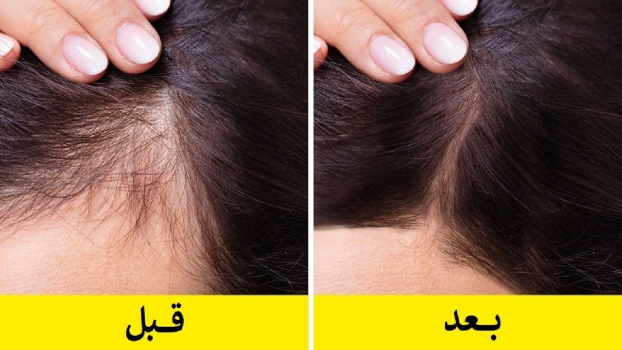 مصرف روزانه گردو چه تأثیری بر پوست دارد؟