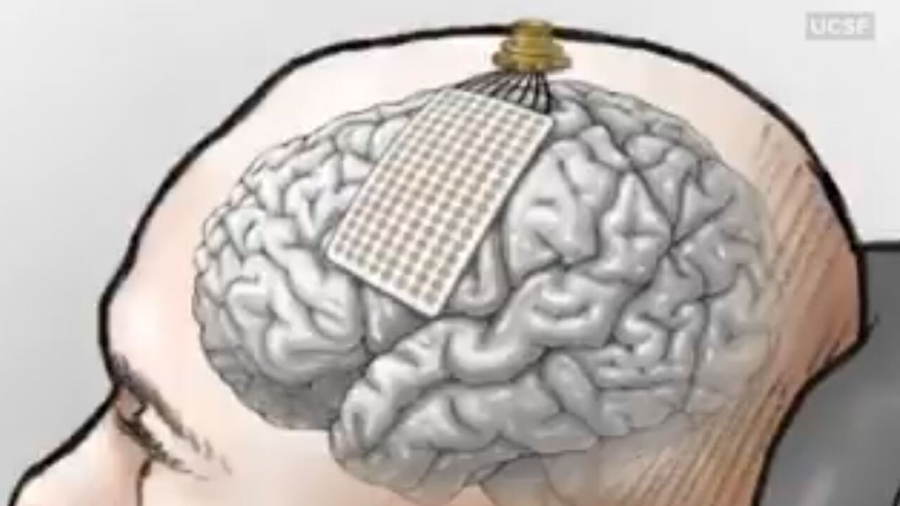 نتایج باورنکردنی نصب ۱۲۸ حسگر در جمجمه یک انسان + فیلم