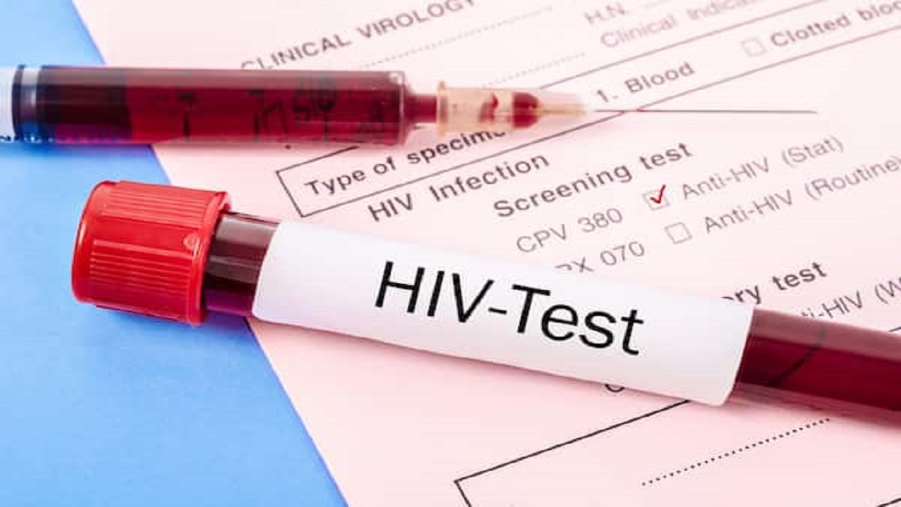 حل معمای سرطان‌های نادری که HIV می‌تواند ایجاد می‌کند