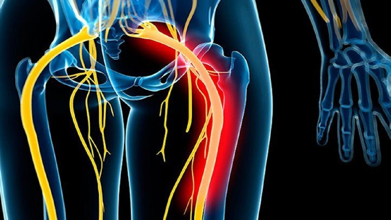 ازخلاصی از فشار کاری با مصرف انار تا تفاوت بین سیاتیک و دیسک&nbsp;