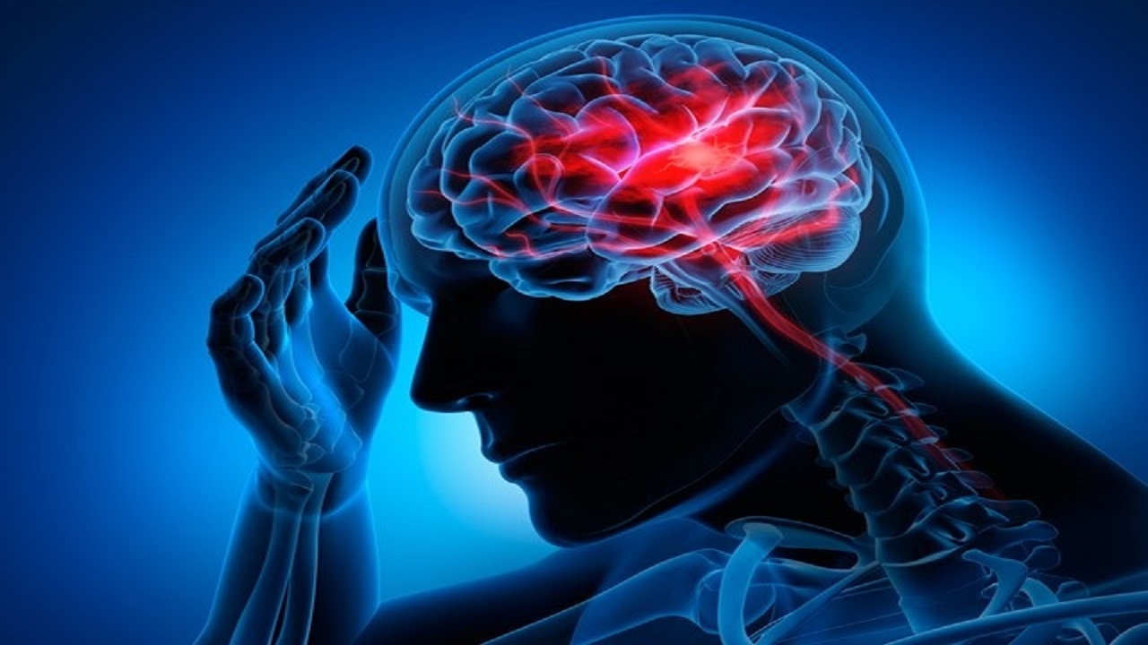 هنگام مواجهه با سکته‌های مغزی چه اقداماتی انجام دهیم؟
