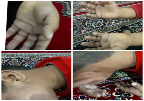 تنبیه بدنی دانش آموز روستایی ایلام 