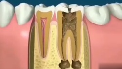 قیمت گرانترین ماسک جهان چقدر است؟ + فیلم