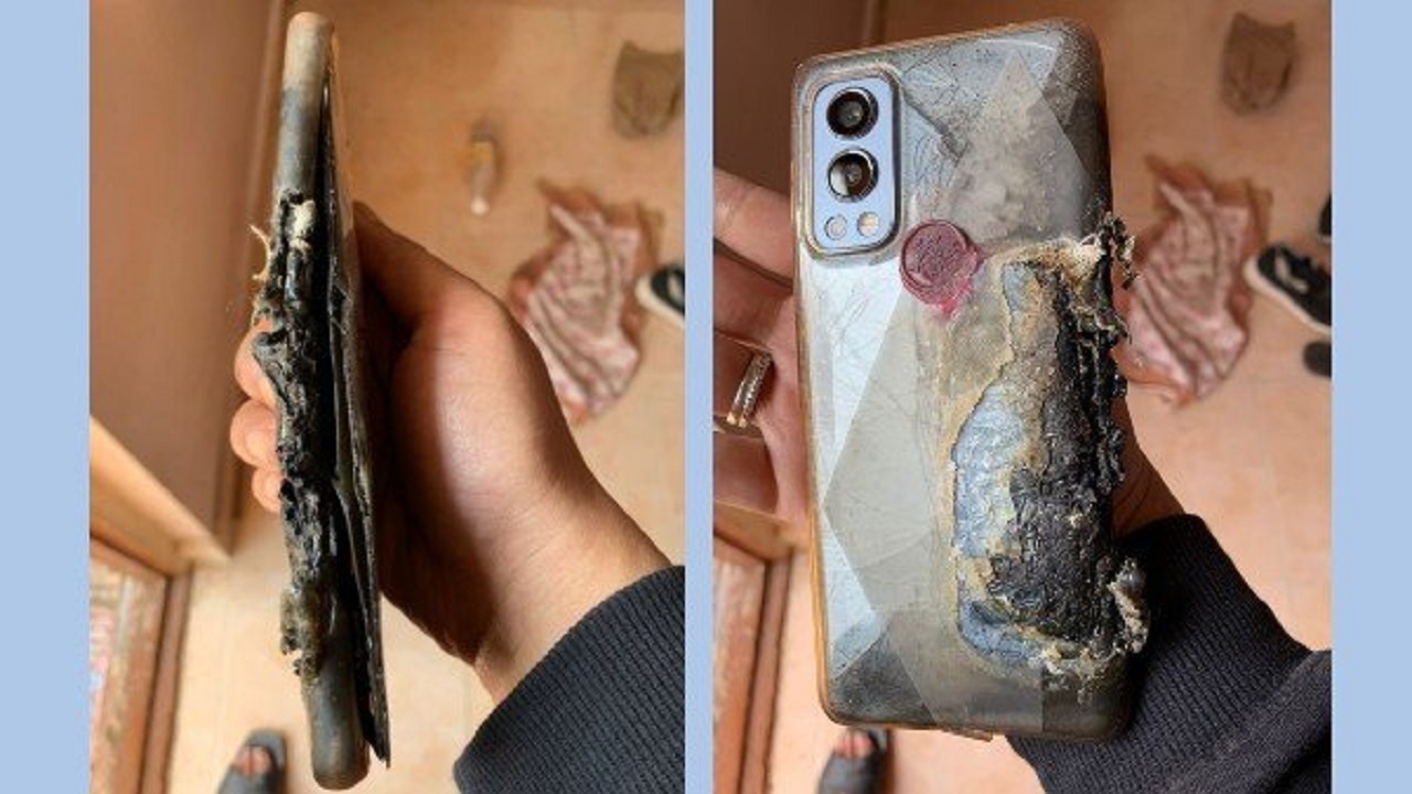 سوختگی شدید یک کاربر به دلیل انفجار گوشی OnePlus Nord ۲