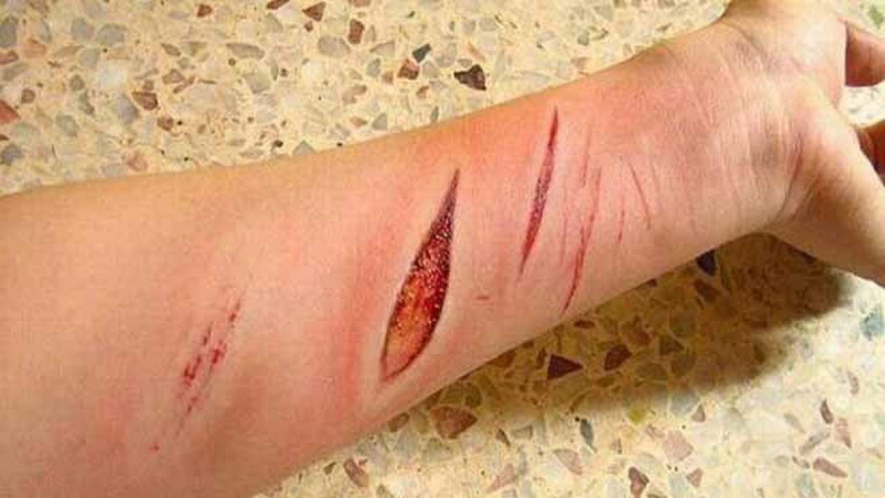 از راه&zwnj;های تشخیص آمبولی ریه تا ۱۰ دمنوش و چای موثر برای مقابله با سرماخوردگی