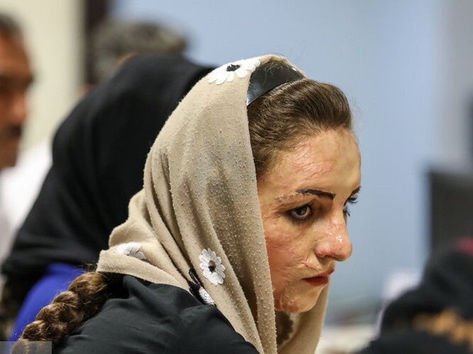 برخی افراد به دلایل مختلف نیازمند جراحی زیبایی هستند