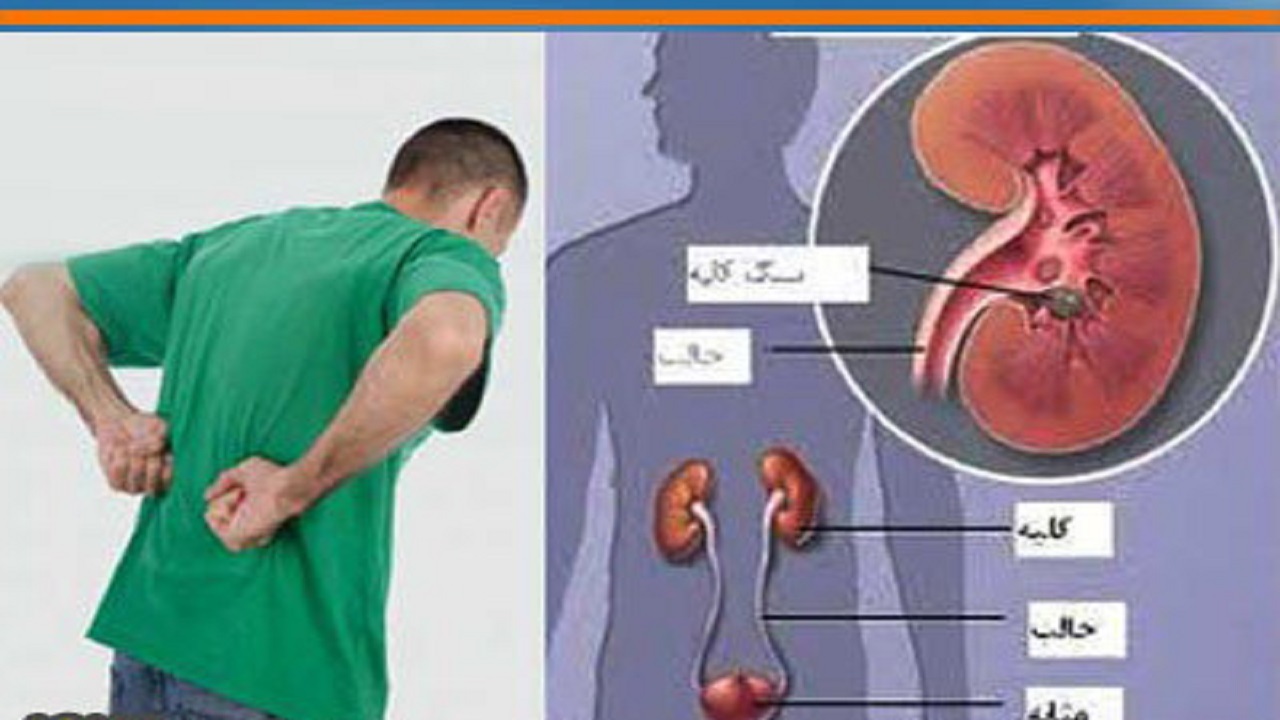 افزایش قیمت پیوند کلیه/توجه به هزینه پیوند کلیه به جای هزینه دیالیز