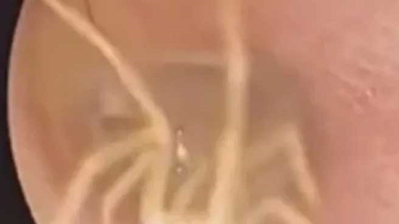 علت عجیب گوش درد زن بیمار