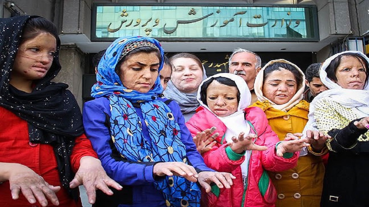 دختران شین‌آبادی از رنج عوارض ناشی از سوختگی و درد فراموشی می‌گویند