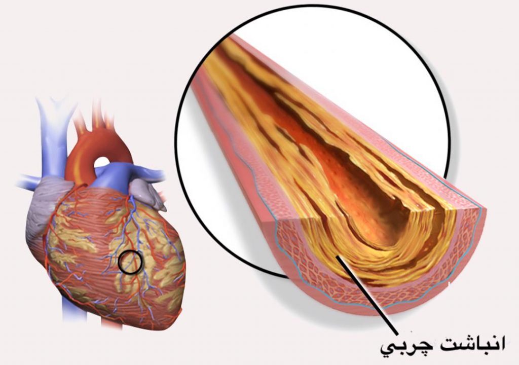 عروق کرونر عروق کرونر