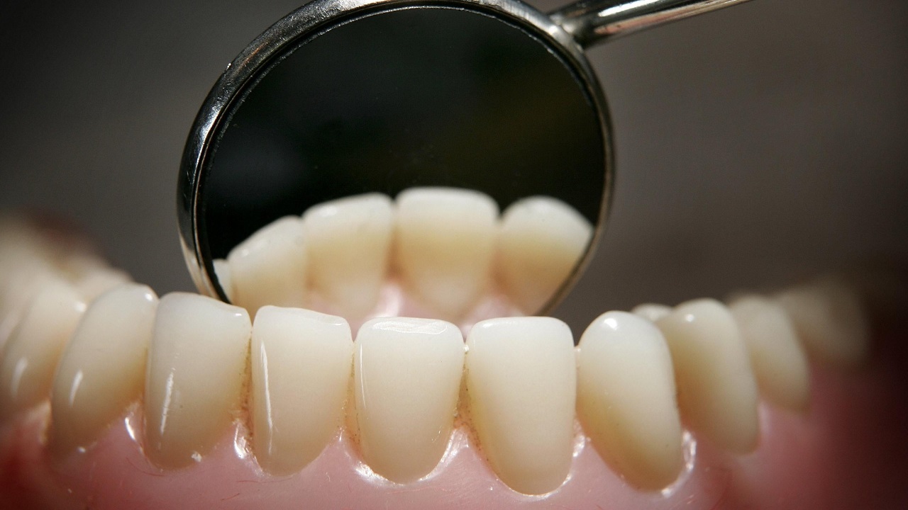 رشد دندان داخل بینی مردی در نیویورک دردسرساز شد