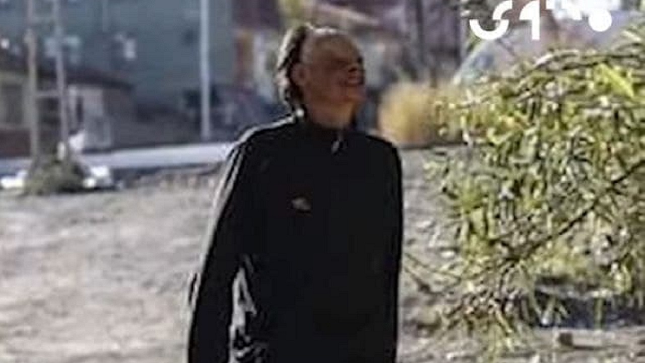جوانی با چشمانی همیشه باز که اطرافیانش از چهره او وحشت دارند