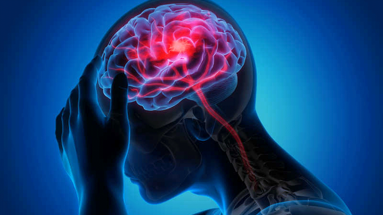 علائم زنگ خطر سکته مغزی + فیلم