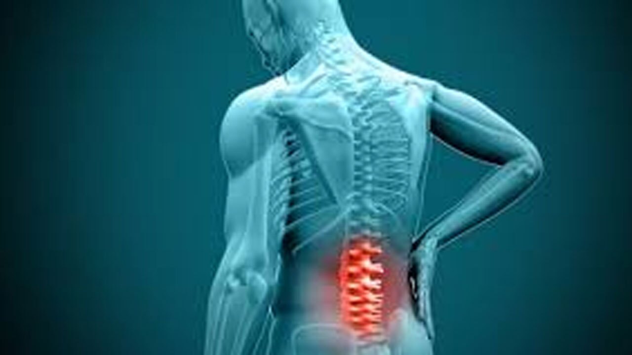 علائم و راه‌های درمان دیسک کمر + فیلم