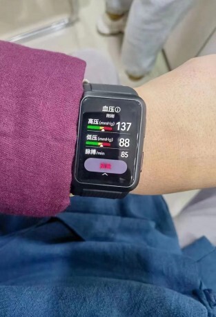 ساعت Huawei Watch D ساعت Huawei Watch D