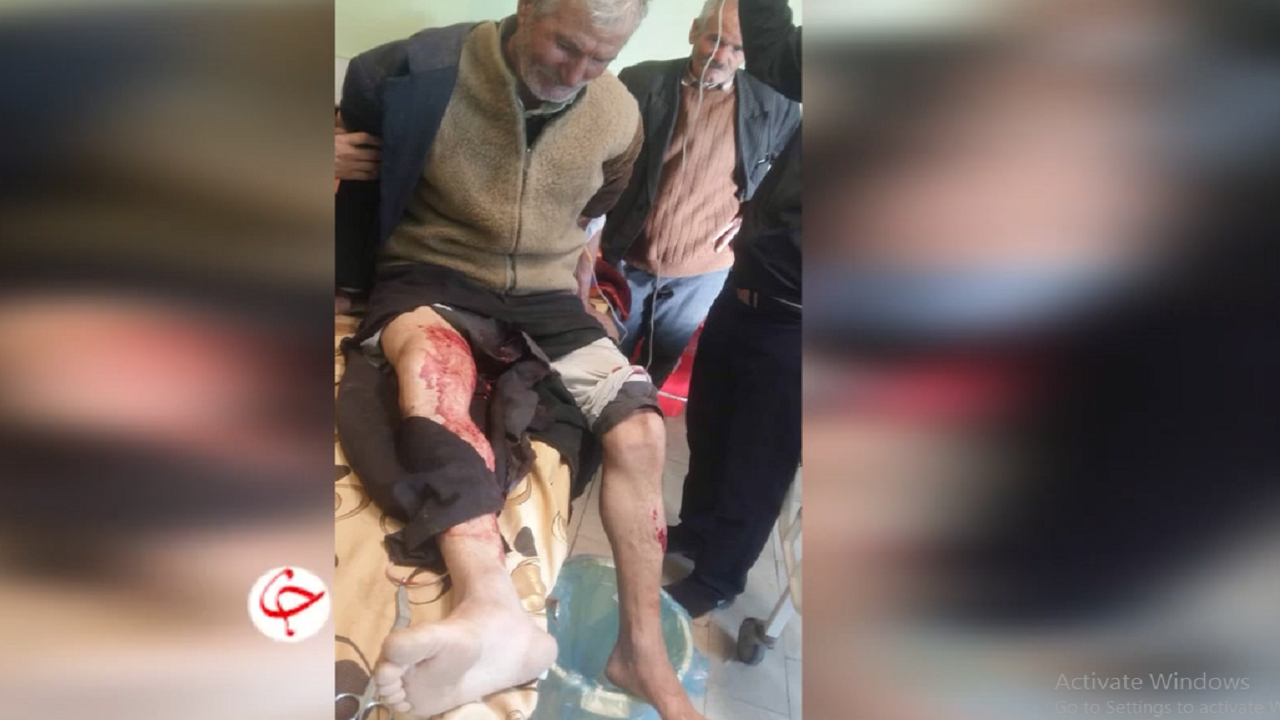 حمله خرس به دو نفر از اهالی روستای آوالان شهرستان هوراند+فیلم