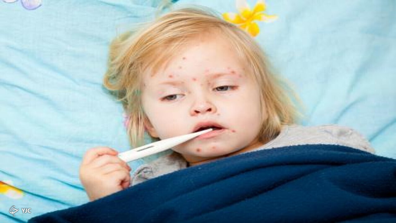 مورد مثبتی از ابتلا به سرخک در خراسان شمالی گزارش نشده است
