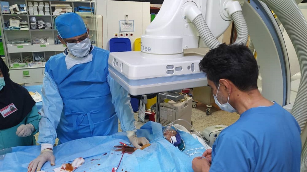 جراحی موفقیت آمیز  آنژیوپلاستی نوزاد نارس ۱۵ روزه در مشهد