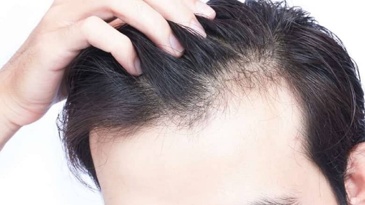 تقویت کننده‌های طبیعی موی سر را بشناسید!