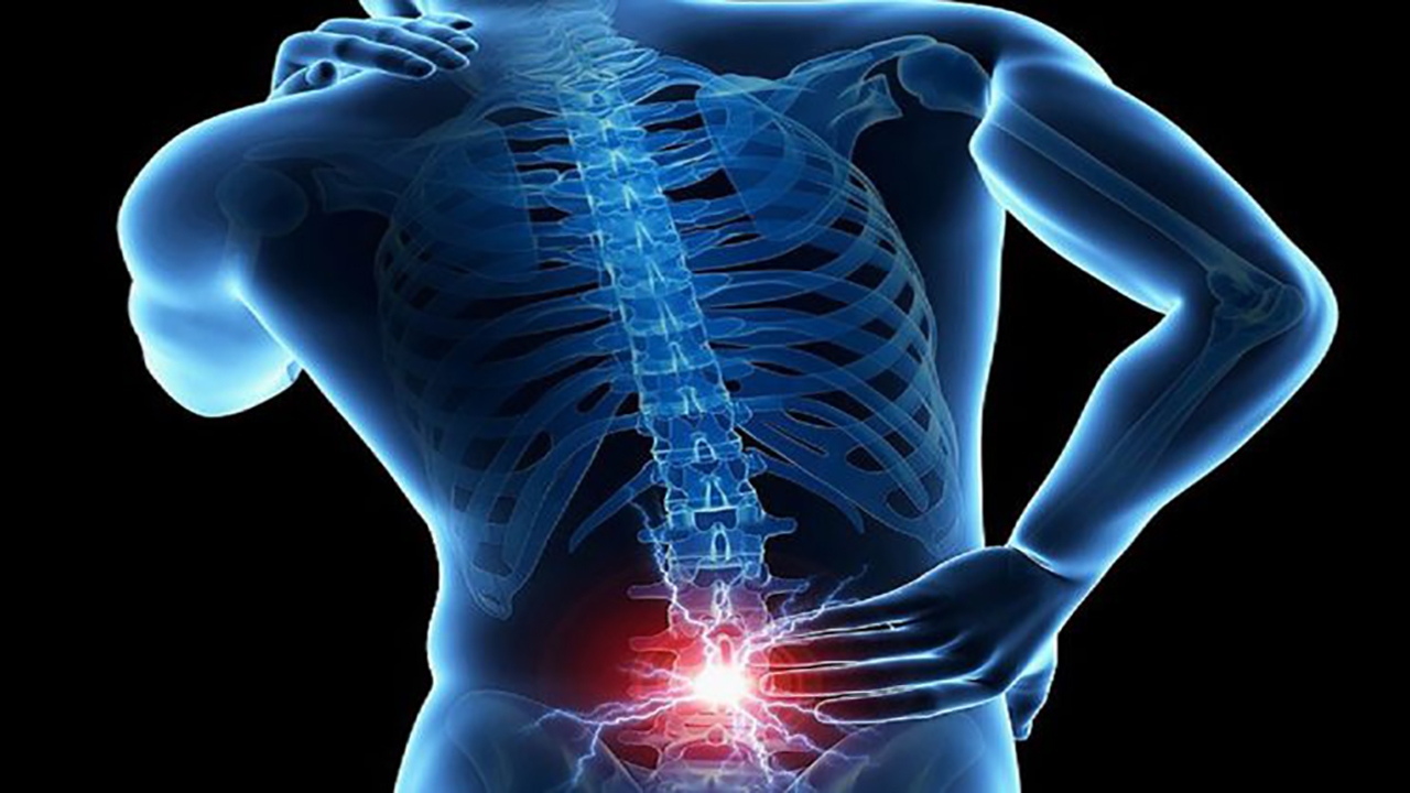 اغلب انسان‌ها دیسک بیرون زده دارند + فیلم